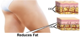 Fat Burner weight loss supplement